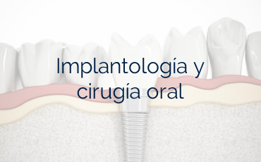 Implantología y cirugía oral