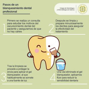 Blanqueamiento dental profesional